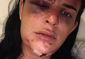 Justiça condena a nove anos de prisão acusado de agredir modelo trans Alice Félis, em Copacabana 