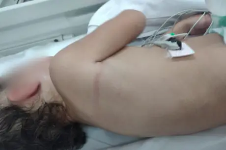Criança fica gravemente ferida após ser maltratada por madrasta em Maricá