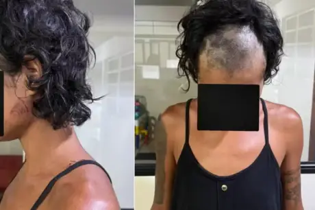  Mulher é torturada pelo próprio marido; ela teve parte do cabelo cortado 
