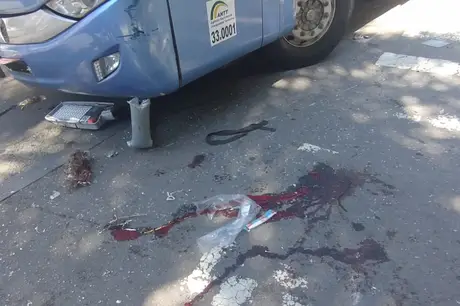 Mulher tem o pé arrancado durante acidente com ônibus no Centro do Rio 