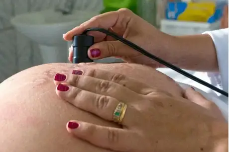 Durante o pré-natal, o teste para HTLV agora é recomendado para gestantes